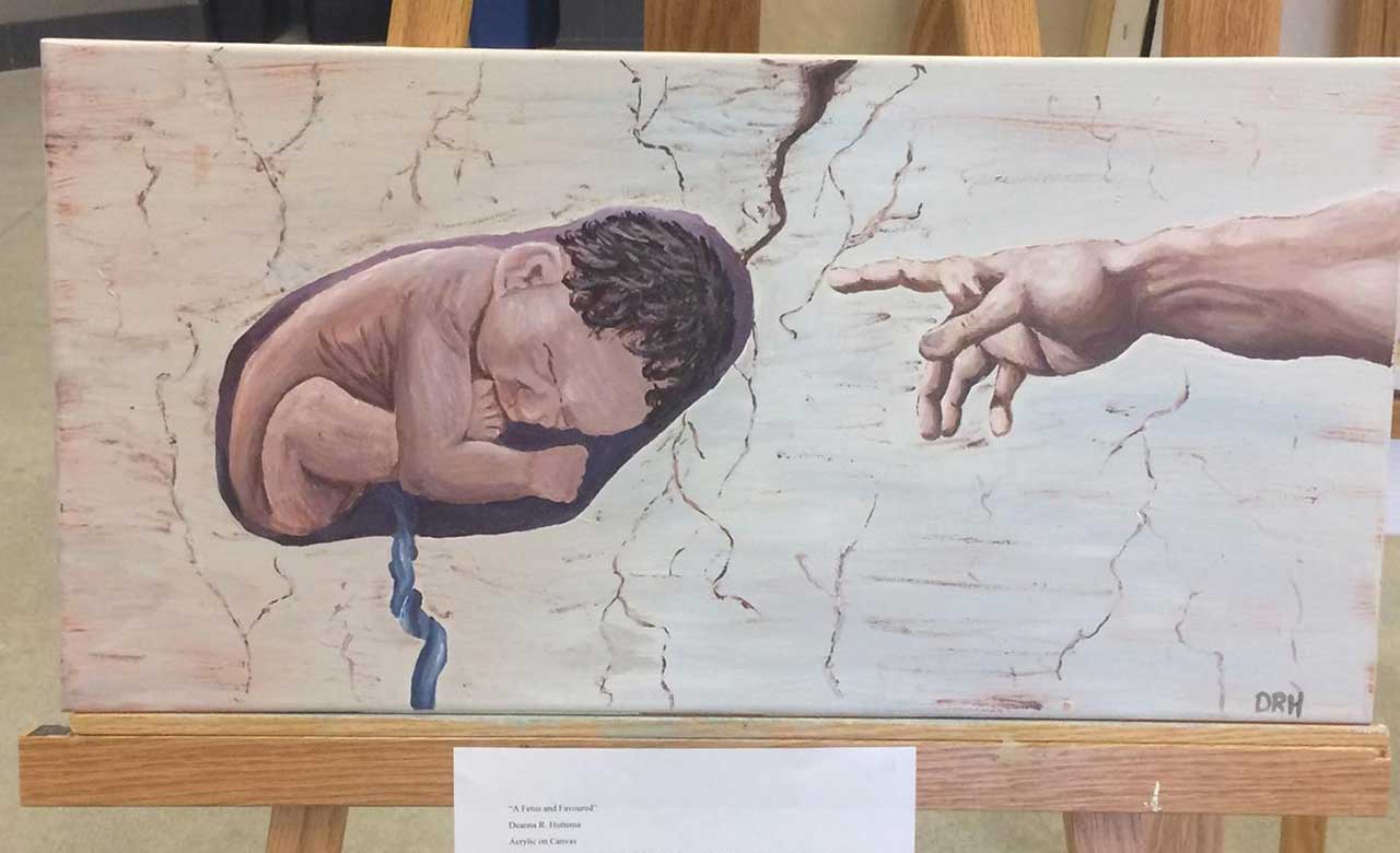 University demands trigger warnings for prolife display. But why