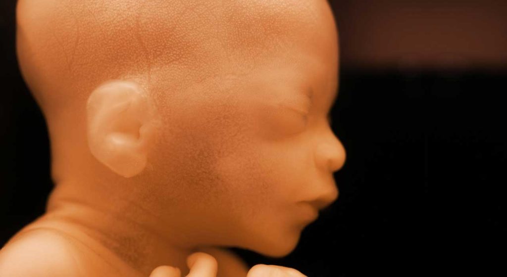 Only one question to debate: What are the unborn?