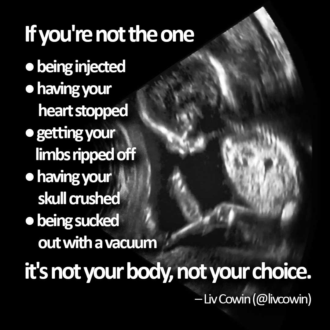 Pro-life memes and cartoons to share