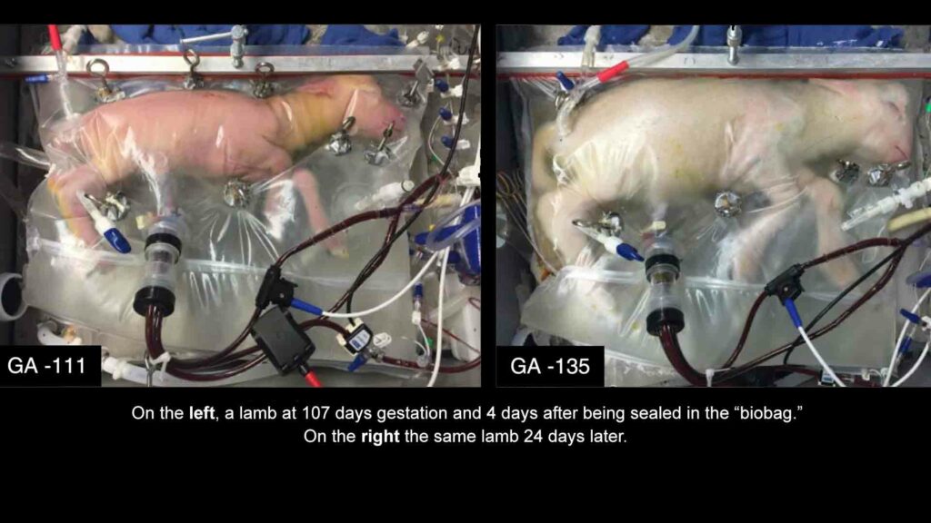 Toronto hospital experiments with artificial wombs
