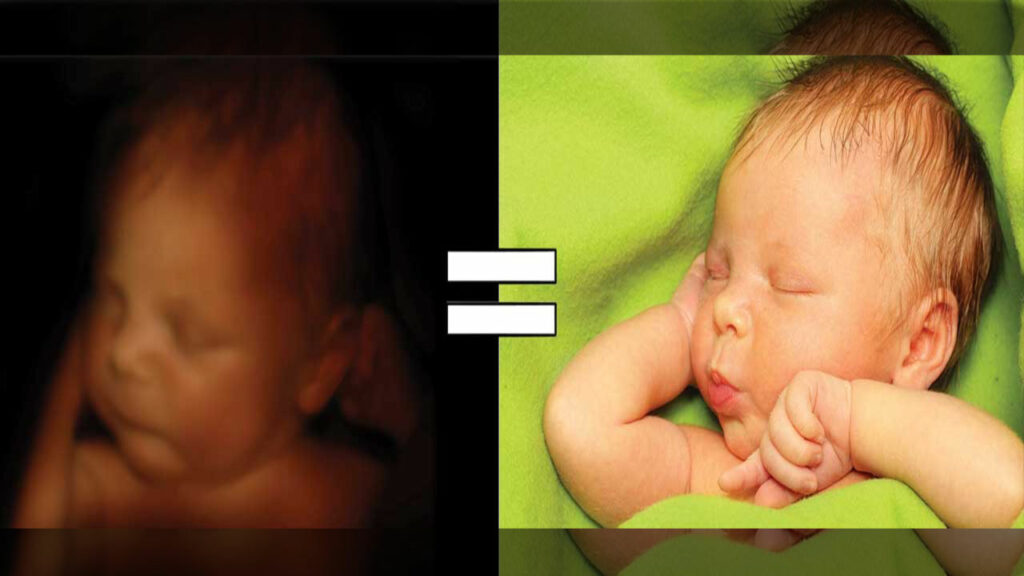 If the unborn are not our equals…