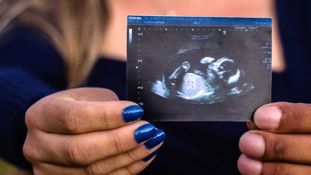 What Exodus 21:22 says about abortion